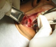 Cirurgia oral e bucofacial