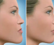 Cirurgia Estética na face
